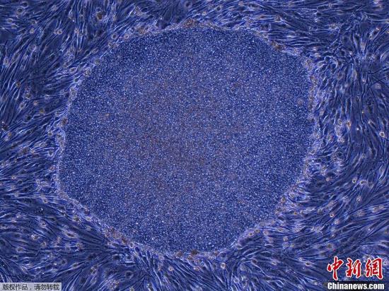 资料图：京都大学iPS细胞研究和应用中心公布的成年人类皮肤成纤维细胞的诱导多能干细胞照片。