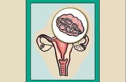 多囊卵巢综合征是种什么病