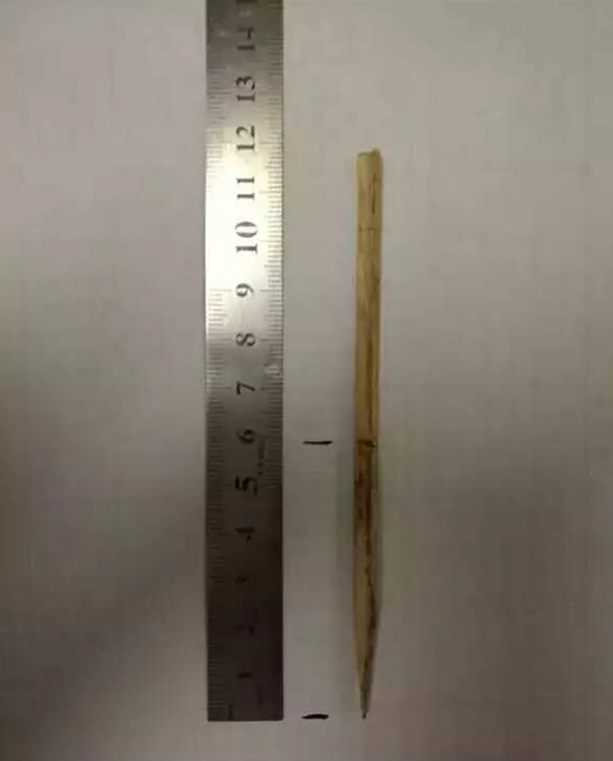 保定两岁男童遭竹签扎脸 竹签足有6厘米长(图)_新浪河北_新浪网
