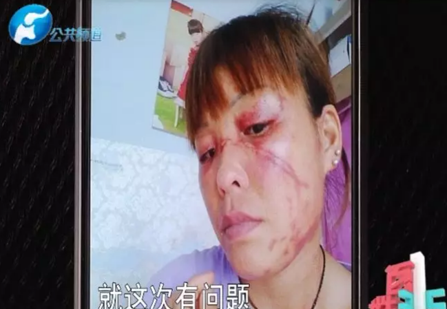 鄭州女子慘遭”毀容”