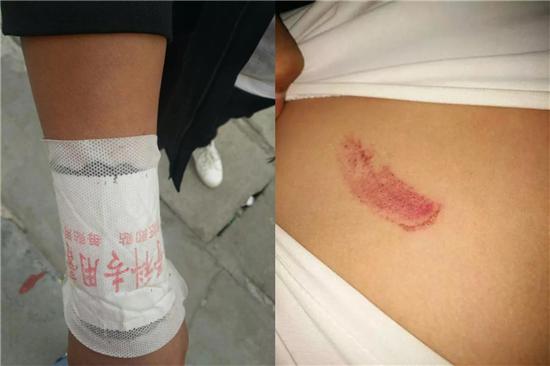 社旗回应体罚学生事件:学生状况良好 老师得到谅解 社旗回应体罚学生事件:学生状况良好 老师得到谅解