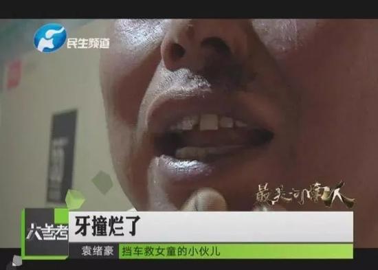当记者询问他的伤势时,袁绪豪只是憨憨的笑着。