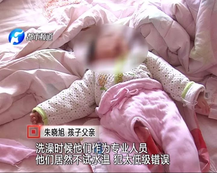 經過轉院治療,朱先生的女兒被診斷為二度燒傷,臀部和腳跟有明顯的燒傷痕跡。