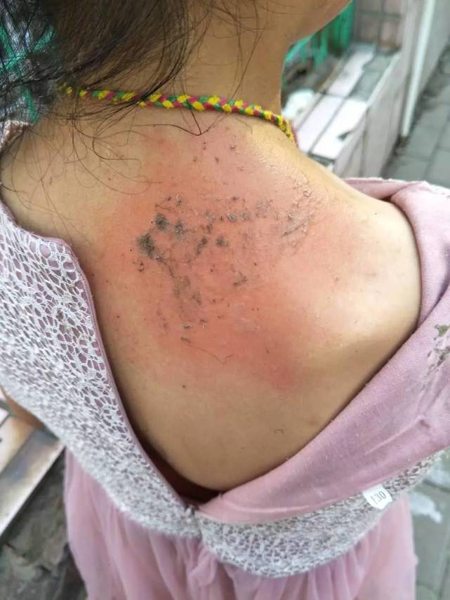 律师观点根据法律受害人损失一定会得到赔偿
