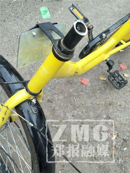 郑州10岁男孩骑共享单车 刹车把手刺入腹股沟