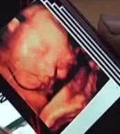 剛從鬼門關撿回一條命的黃琴琴決定