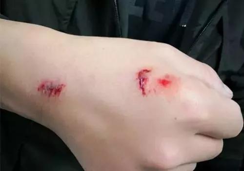 最后,在周围群众配合下,男青年被控制,并被闻讯赶到的民警带走。