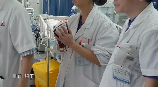 抢救的第八个小时,邹石的血氧饱和度终于上来了,这让医生看到了一丝希望 。