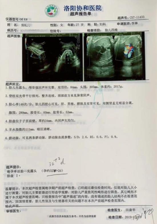 有一次因为出差在郑州做了b超,其余每一项孕检都是在洛阳安和医院做的