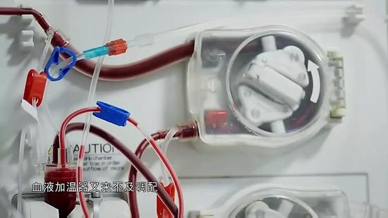 血液净化可能是救命稻草,也可能是致命帮凶。