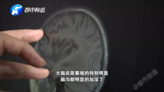 看着躺在病床上的妞妞