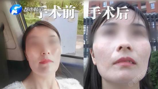 整容能旺夫？薇格斯美容醫(yī)院看到結果后：不想多說 我們退錢！