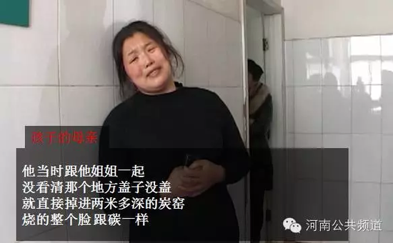 8岁孩子整张脸被烧成黑炭 无钱救治母亲几近崩溃