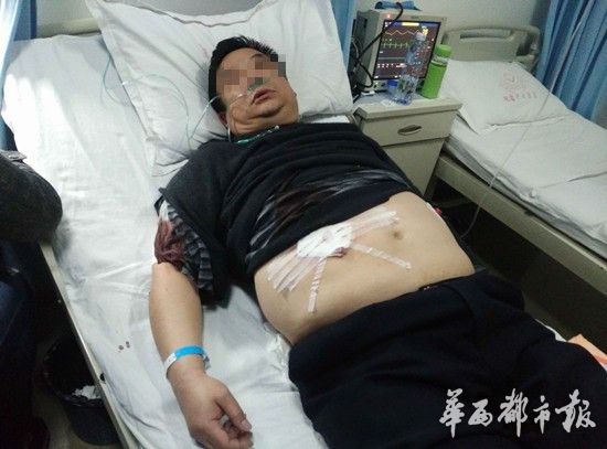 受伤民警