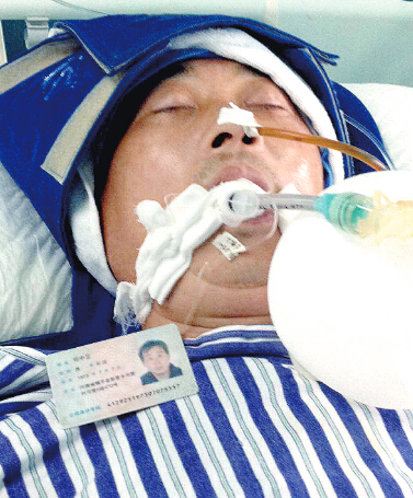 被撞环卫工仍昏迷不醒