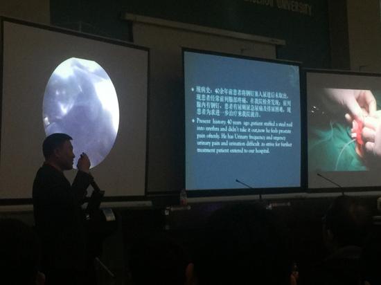 第18届APAPU年会主席 郑州大学第一附属医院副院长 中国医师协会小儿外科分会副会长 文建国 对直播的手术进行解读