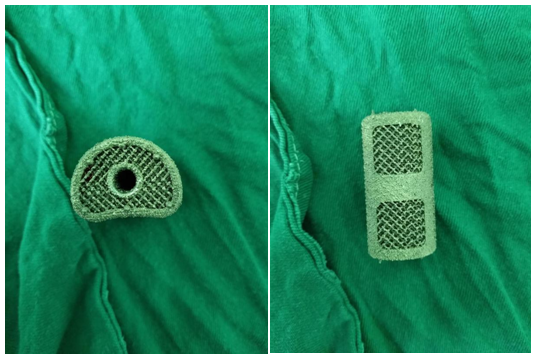 3D打印出的人工假体