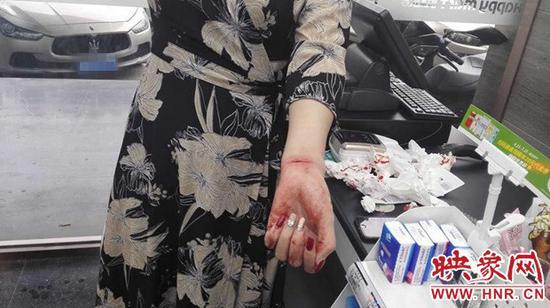 Ů��������ܴ������ɱ ֣����5���Ӹϵ��ֳ�Ӫ��