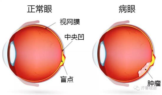 示意图来源：news-medical.com