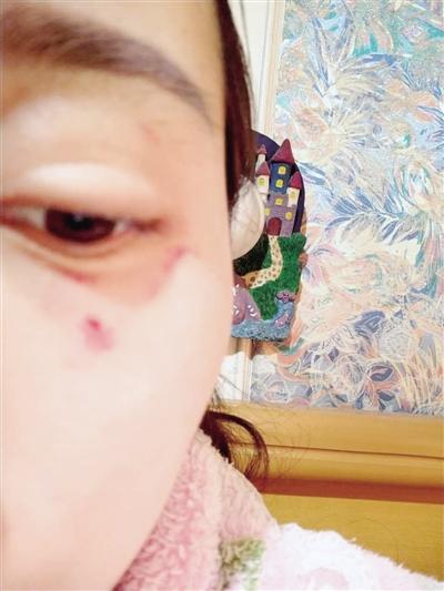 郑州女子网购投诉遭卖家千里追打 警方已介入