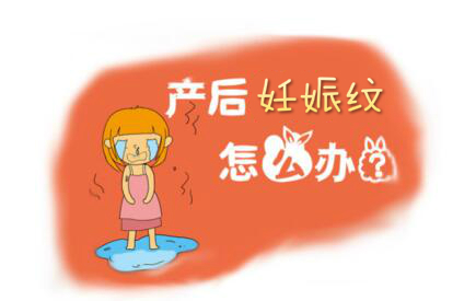 怎样去除产后妊娠纹 产后去妊娠纹的有效方法