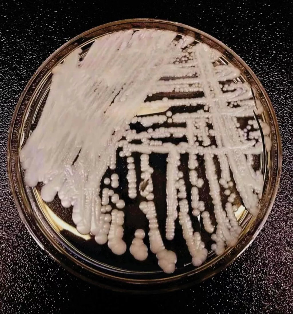 培养皿中的耳念珠菌菌株。图源：美国CDC官网