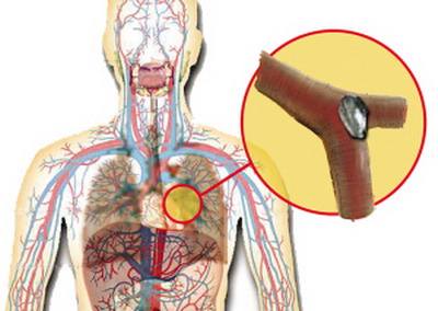 什么时候可以去拍ct nYyw-fykcpsc5638798.jpg