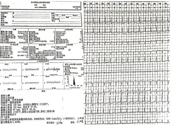 动态心电图报告 c4c1-d0d091d86dcea216ed626c2f4bbc1328.png