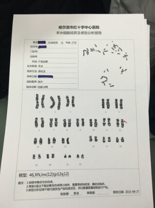 哈尔滨市红十字中心医院发现世界首例染色体核