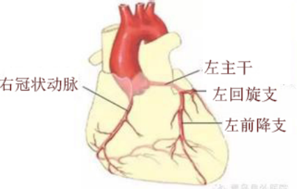 三支血管病变咋治?传统心脏搭桥难免心肌损害!