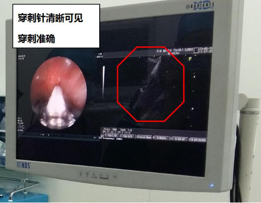 哈医大四院呼吸科联合西安唐都医院呼吸科共同