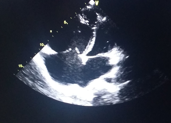 病少女要命还是要美?远东医院微创修补房缺手