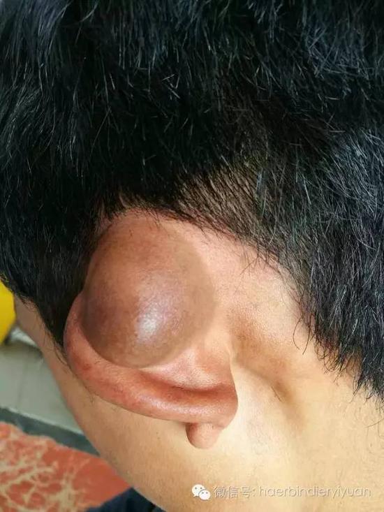 【新浪医讯】哈尔滨市第二医院援藏的医者路(