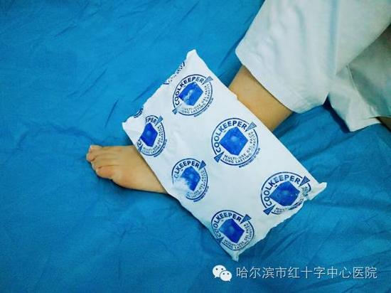 踝扭伤在外力作用下,踝关节骤然向一侧活动而超过其正常活动度时,引起