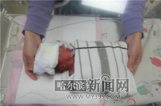 市四院卫生间捡到的弃婴“仁里”正在市儿童医院NICU接受救治。　杨锐摄