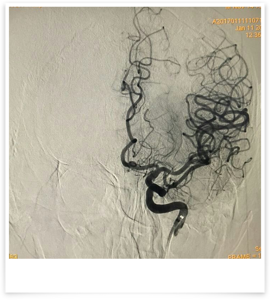 【医讯】哈医大一院神经内外科联合抢救院内突