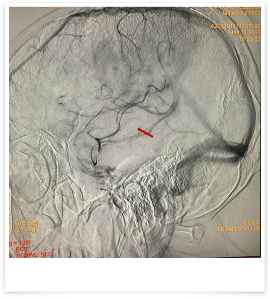 【医讯】哈医大一院神经内外科联合抢救院内突