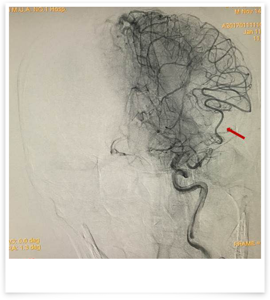 【医讯】哈医大一院神经内外科联合抢救院内突