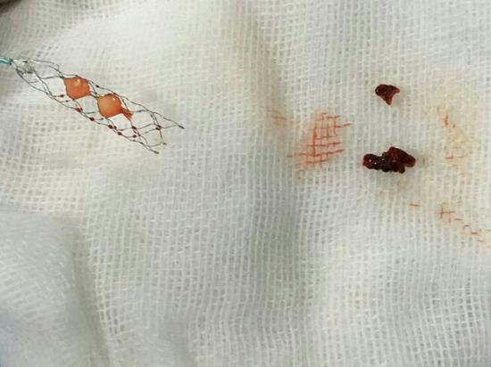 【医讯】哈医大一院神经内外科联合抢救院内突