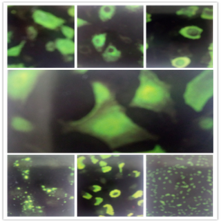 图为：各种病原体在荧光显微镜下的图像