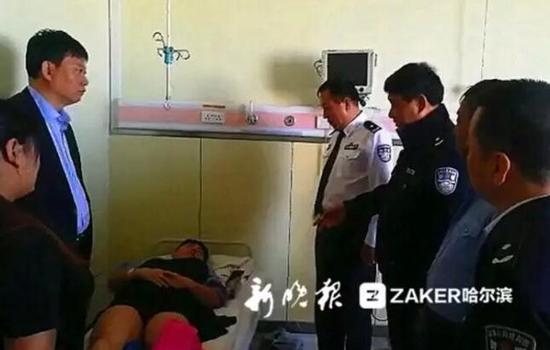 辅警小李左胫骨上段骨折。