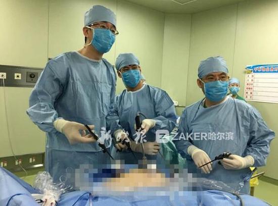 女子便秘39年腹如怀胎八月 手术竟切出20斤病