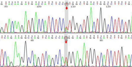 图1 患者Sanger验证结果及双向测序峰图