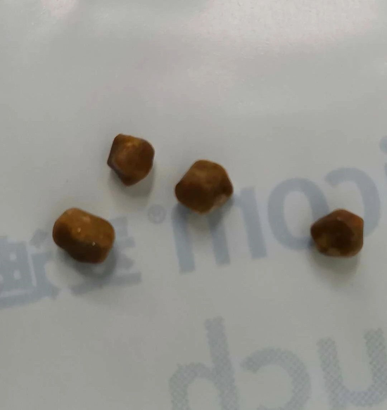 术中取出的胆结石