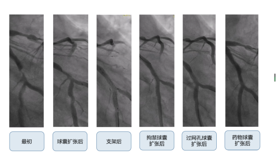 图3：各主要阶段对比