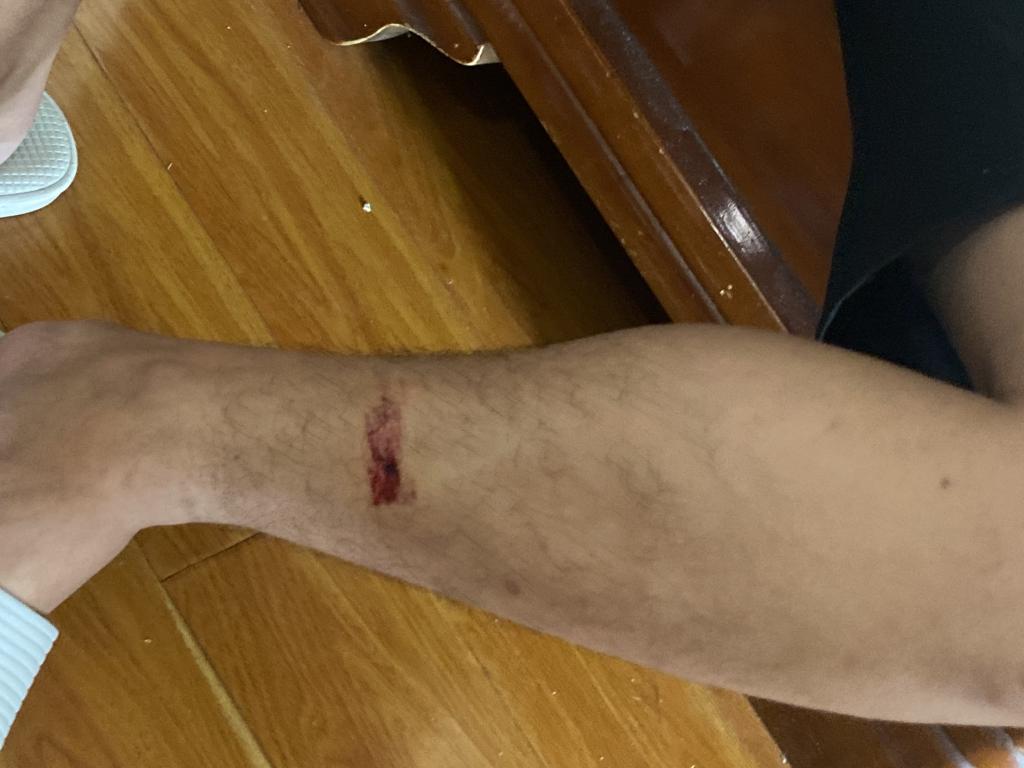 长沙一小区墙体从天而降!散落石块飞进楼内砸伤 2 人