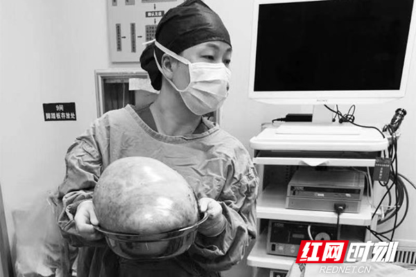 通过手术切除的肿瘤装满一脸盆，有10余斤。