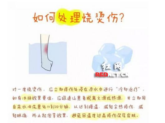 中南大学湘雅二医院烧伤整形美容外科王先成博士解答一度烧烫伤处理方法。