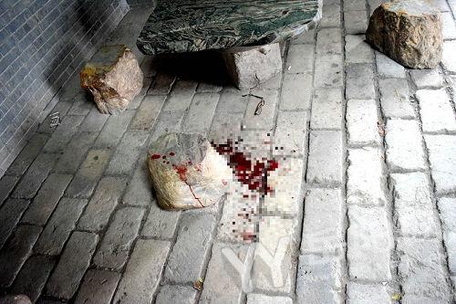 小伙被女人亲出血倒地不起 岳阳大哥仗义相救