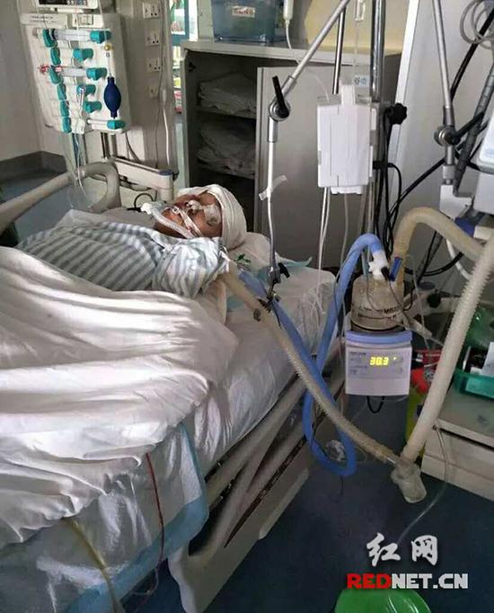 躺在重症监护室里的刘泽玮目前全靠呼吸机维持生命体征。
